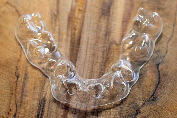 Invisalign Flensburg